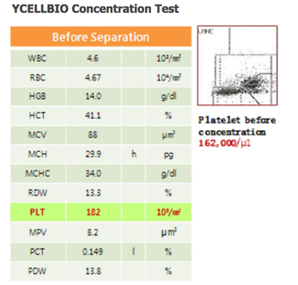 PRP Better Concentrations PRP Gold Coast Treatment Most effective